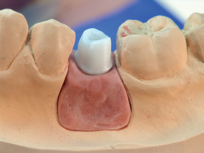 primopattern Light Cured Pattern Resin primotec