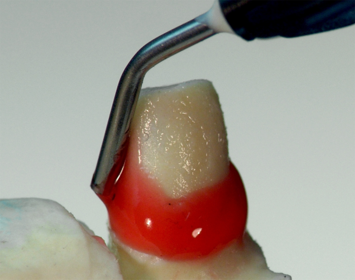 primopattern Light Cured Pattern Resin primotec